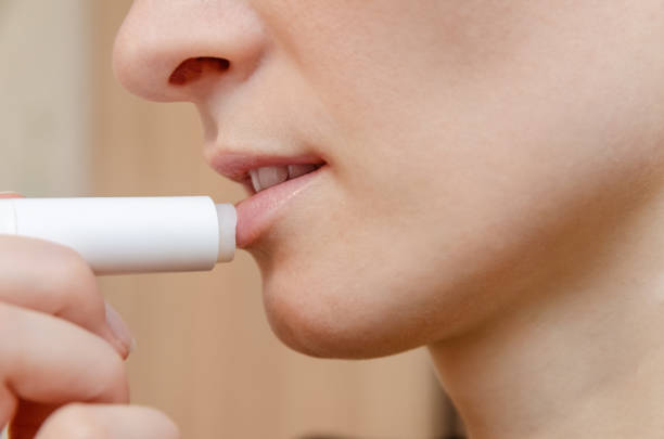 image - Guide to Choosing a Lip Balm for Dry Lips in Malaysia